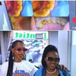 Video: Watch as Spice Diana’s gets dental surgery Video: Watch as Spice Diana’s gets dental surgery
